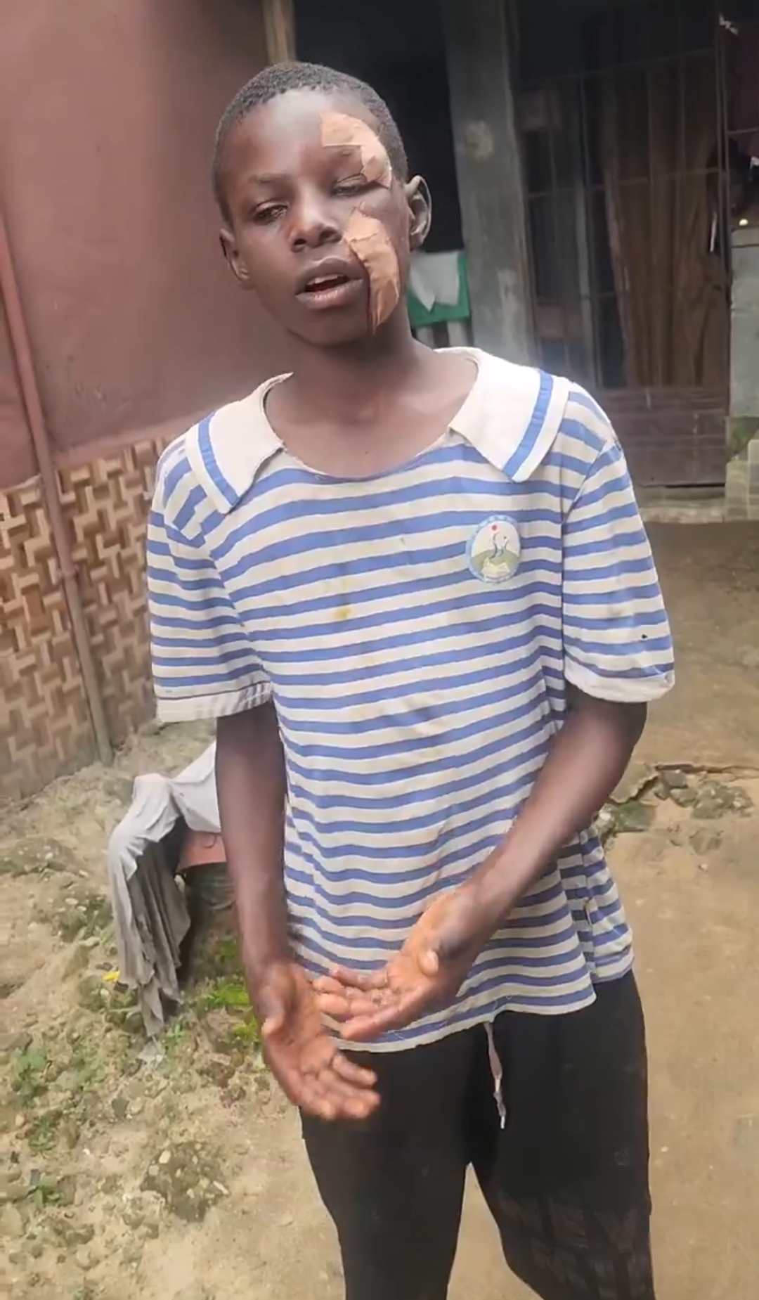 OUTRAGE IN ABA AS 16-YEAR-OLD ENUGU INDIGENE IS SEVERELY BRUTALIZED BY AUNT OVER UNWASHED COOLER