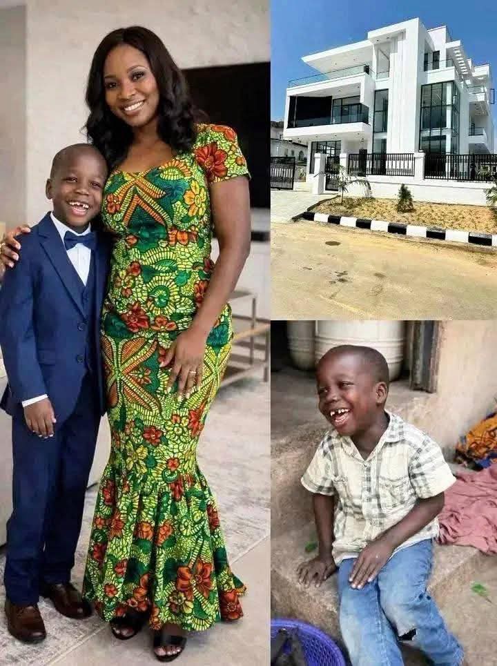 FROM HARDSHIP TO HOPE : THE VIRAL STORY OF ALBERT'S LIFE -CHANGING SMILE